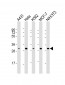 CDK4 Antibody [Knockout Validated]